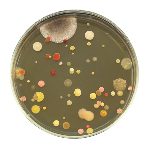 Medios cromogénicos: Bacteriología en color
